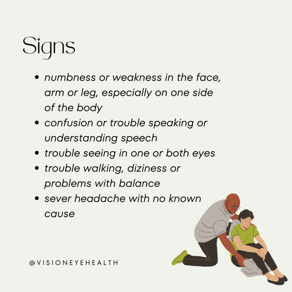 Signs of eye stroke